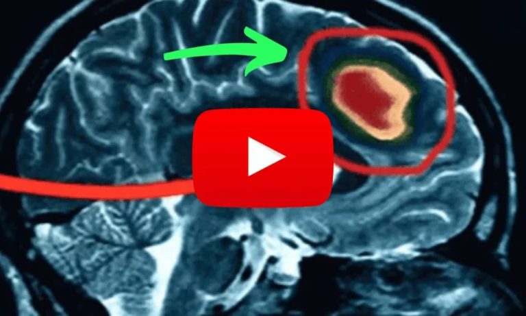 Mulher aliviada após parar zumbido no ouvido